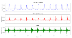 Actual low-frequency NCS, high-frequency NCS, and audio reference for one articulation