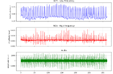 Actual NCS and audio traces across a complete word routine